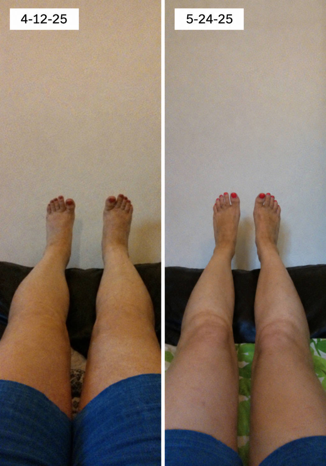 before and after alder_ba_05.png