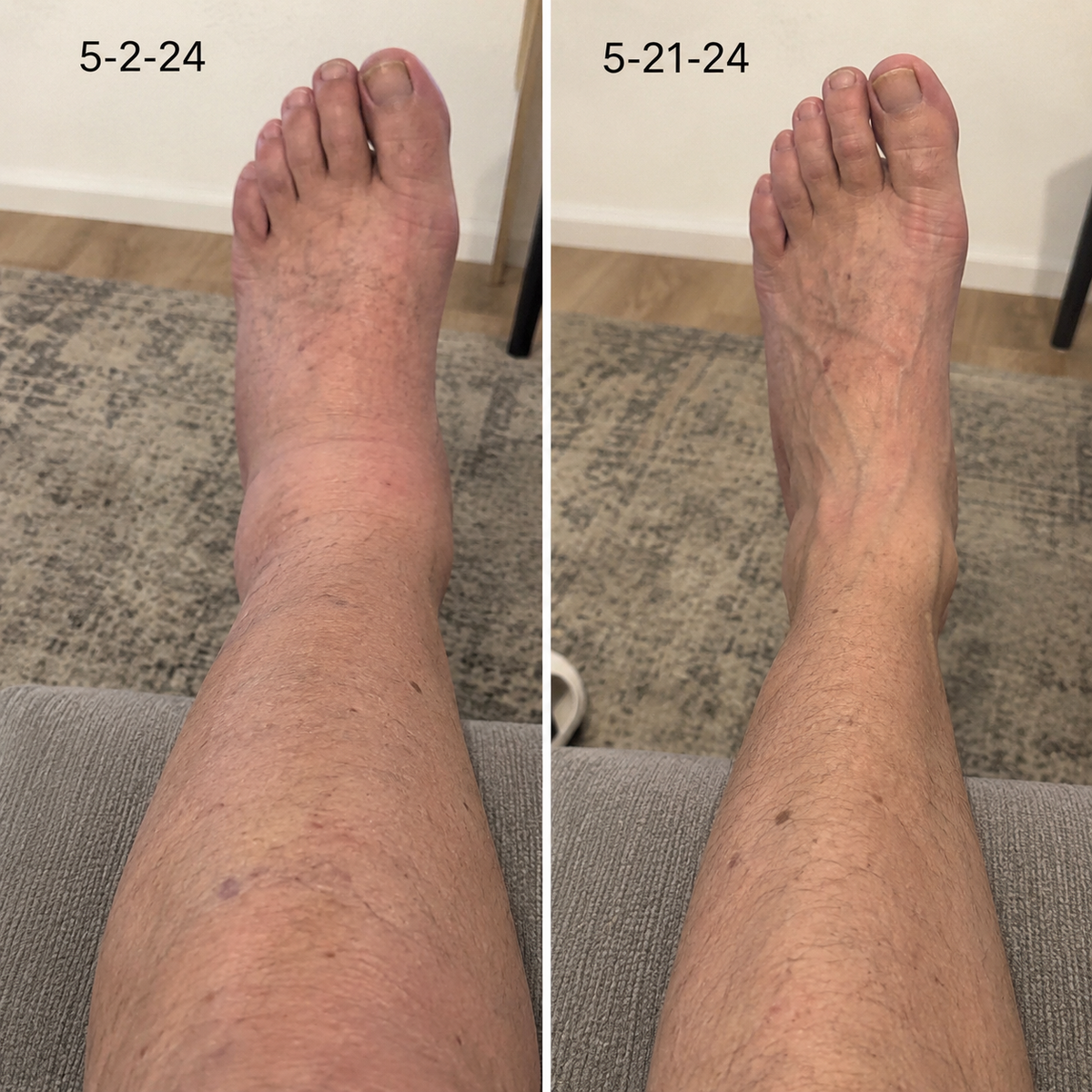 before and after alder_ba_06.png