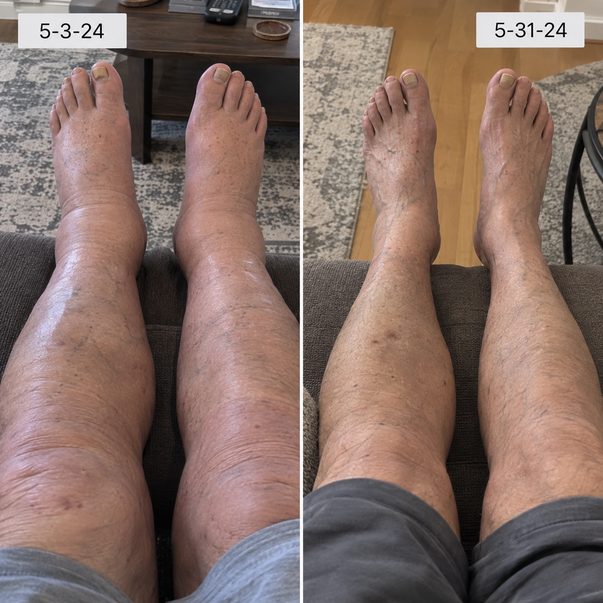 before and after alder_ba_07.png